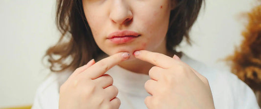 Femme observant sa peau dans un miroir, préoccupée par des imperfections du visage (boutons, taches ou rougeurs)