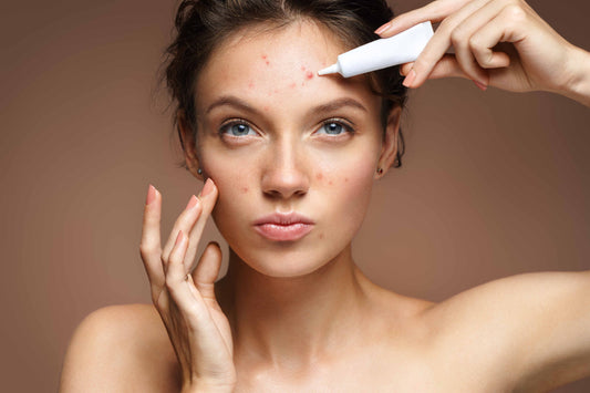 Produits anti-acné en vente sur laparadulac.com – parapharmacie Tunisie avec soins contre les boutons et imperfections à prix réduit