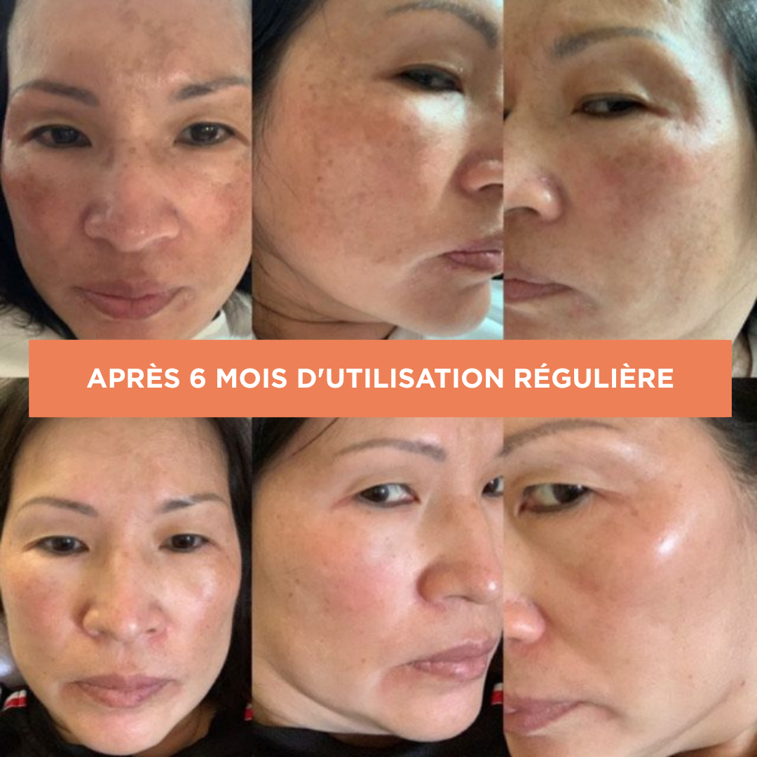 Crème solaire triple action SPF, anti-âge, anti-taches et éclaircissante, enrichie en niacinamide, AKOActive et Tinosorb M/S – disponible sur laparadulac.com, parapharmacie Tunisie.