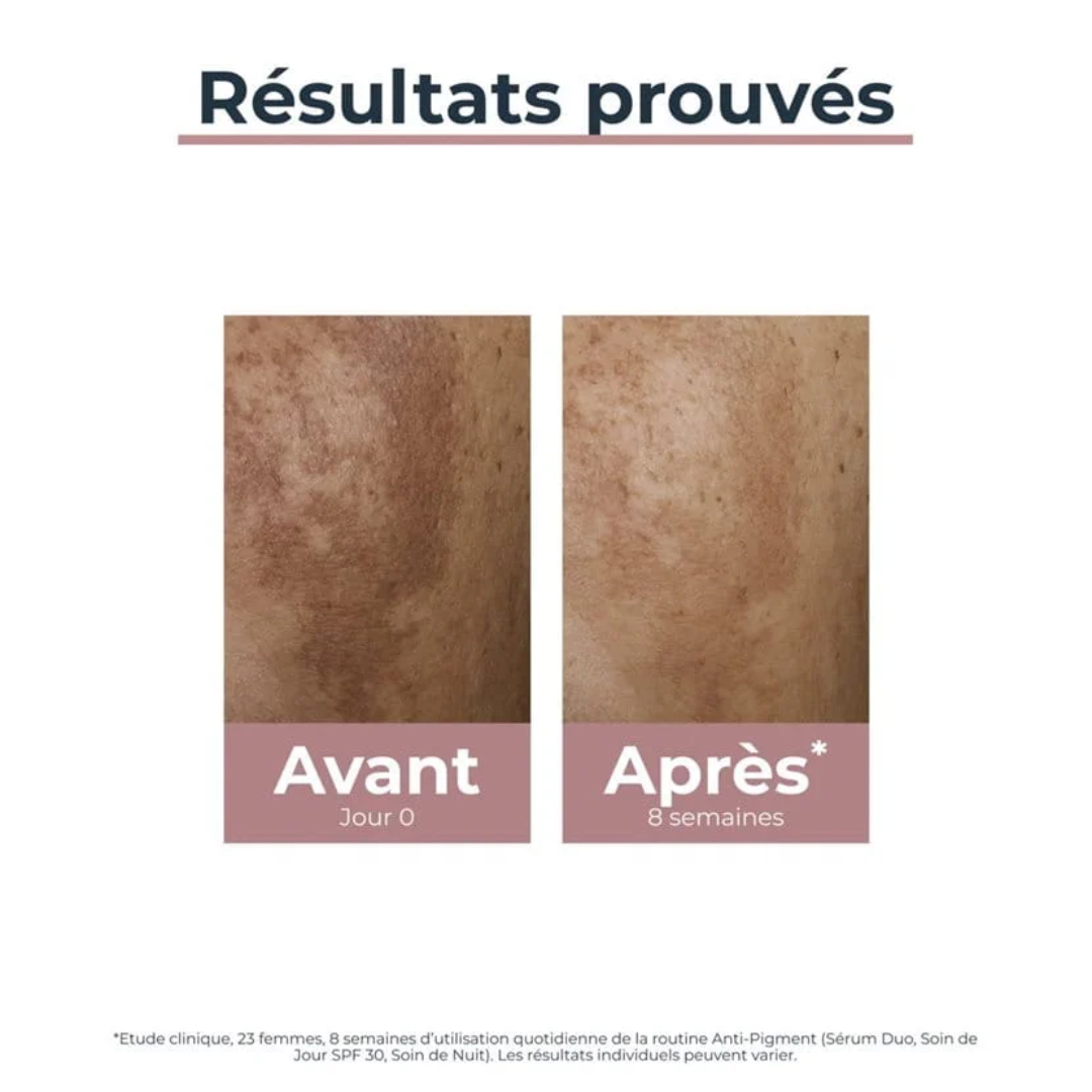 Sérum anti-taches Eucerin Anti Pigment disponible sur laparadulac.com parapharmacie Tunisie pour un teint uniforme et lumineux