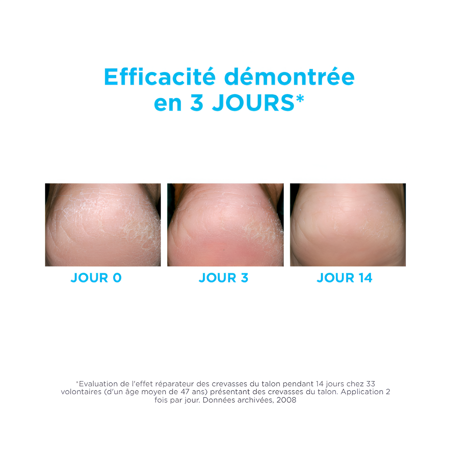 ISDIN Ureadin Podos Gel-Huile 75 ml – soin hydratant et réparateur pour pieds secs. Disponible sur laparadulac.com, Laparadulac Parapharmacie Tunisie.