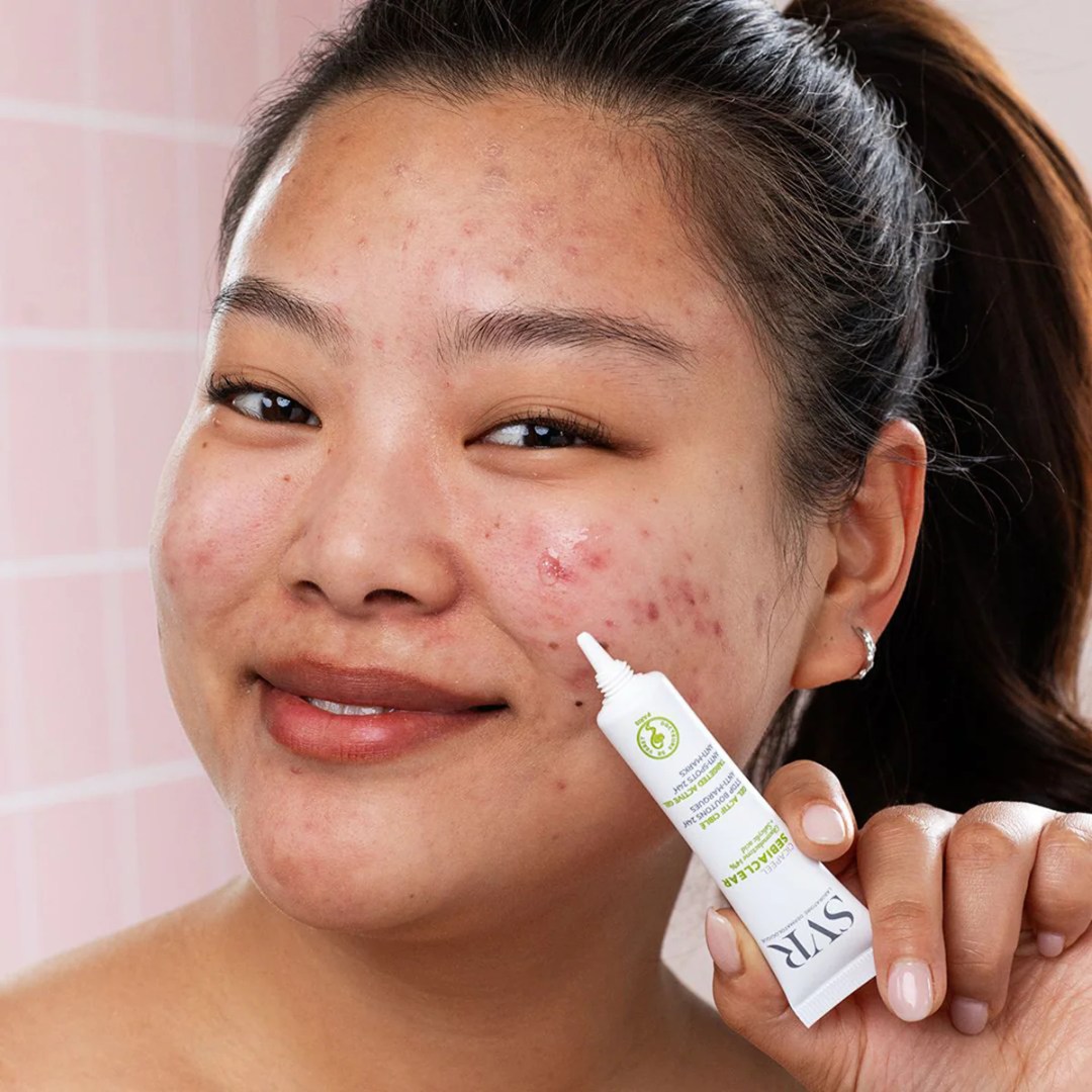 SVR SEBIACLEAR Cicapeel Gel Actif 15 ml – soin local anti-boutons et imperfections, disponible sur laparadulac.com, parapharmacie en ligne en Tunisie.