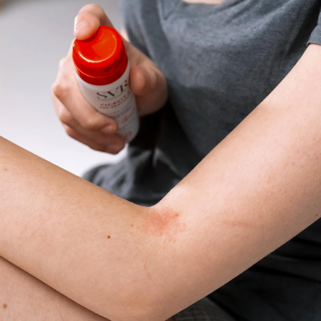 Spray apaisant SVR Cicavit+ Grattage 40ml en vente sur laparadulac.com – parapharmacie Tunisie pour soulager démangeaisons et irritations cutanées.