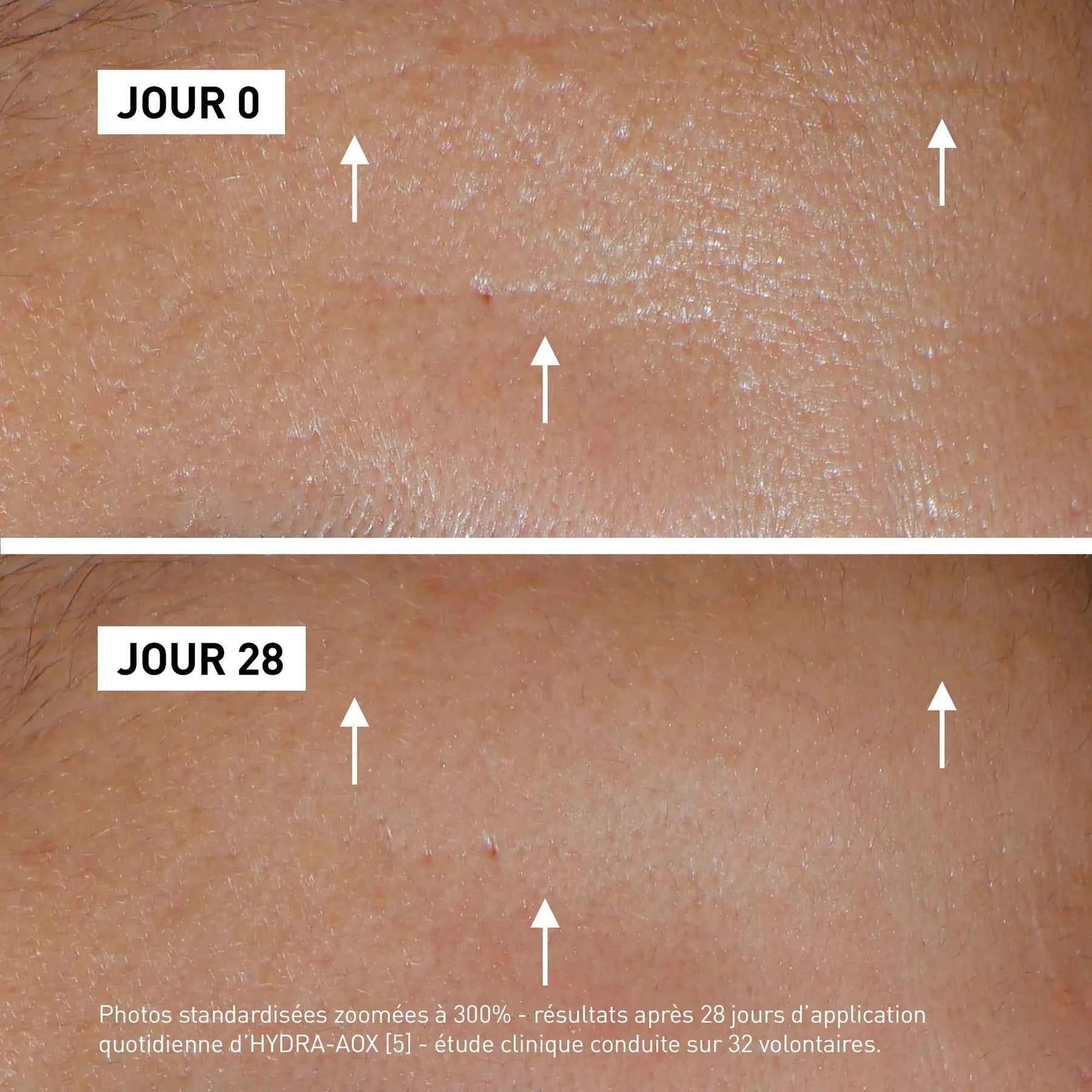 Filorga Hydra-AOX [5] sérum antioxydant en Tunisie – sérum visage hydratant + éclat, protège contre stress oxydatif (selon formule), aide à lisser ridules et illuminer le teint, parapharmacie en ligne La Para du Lac laparadulac.com, livraison rapide, prix.