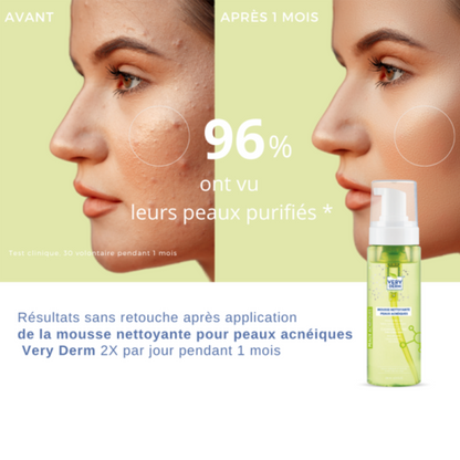 Very Derm Mousse Anti‑Acné (clou de girofle & géranium) 200 ml – nettoyer & purifie les peaux acnéiques, disponible sur laparadulac.com, parapharmacie Tunisie.

