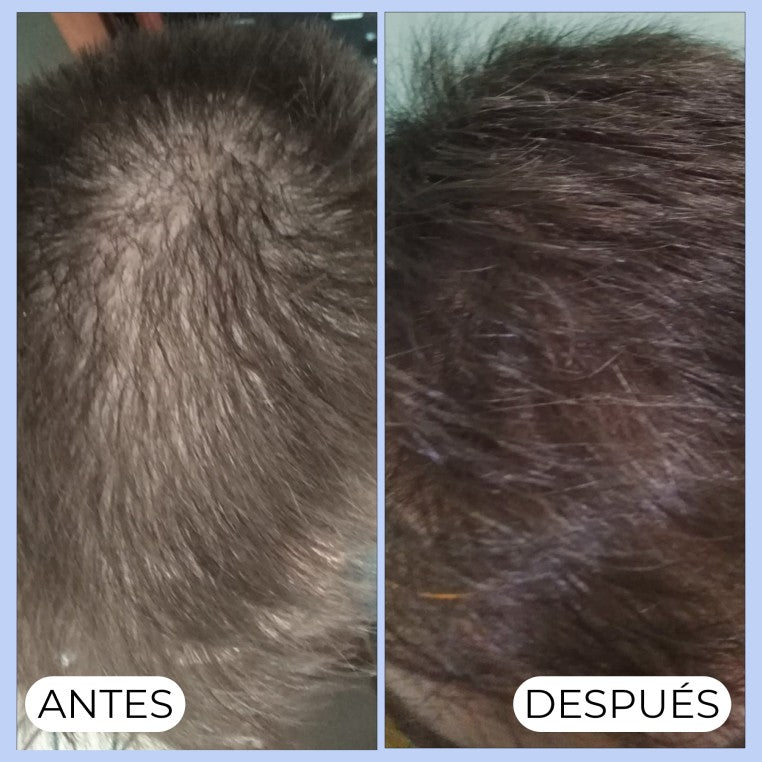 Photo du shampooing ALMA SECRET Shikakai 500ml fortifiant anti-chute anti-pellicules Tunisie