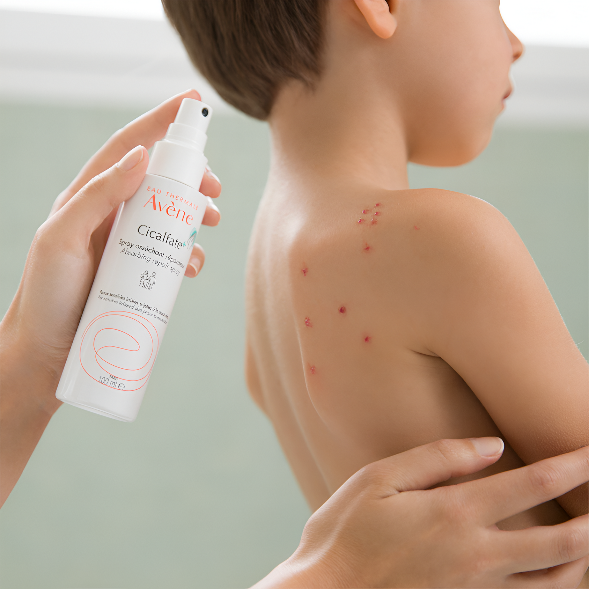 Spray réparateur asséchant Avène Cicalfate+ 100ml pour peaux sujettes à macération – disponible sur laparadulac.com

