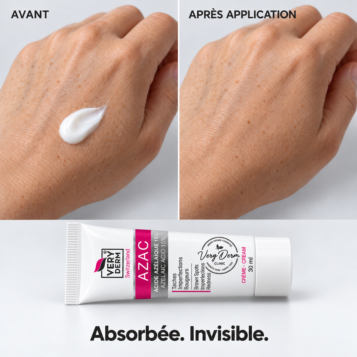 Démonstration de la texture de la crème AZAC Very Derm 30ml : avant et après application, absorbée et invisible sur la peau