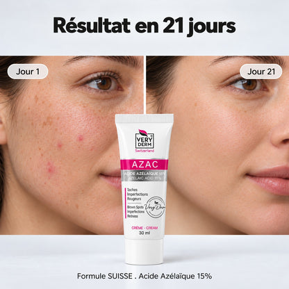 Résultat en 21 jours avec Veryderm Azac Crème Acide Azélaïque 15% : avant et après le traitement des taches, imperfections et rougeurs, disponible sur laparadulac.com en Tunisie.